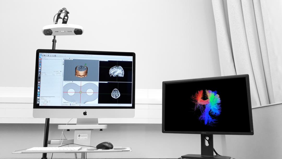 Tractography-guided Neuronavigation
