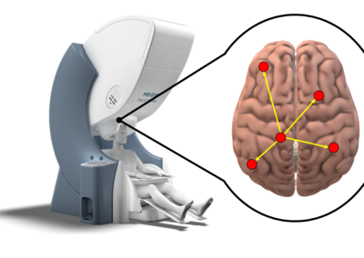 Perfomances-MEG & EEG & MRI 3T Study