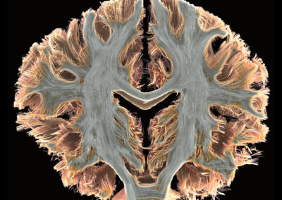 Curious Brain-MRI 7T Study