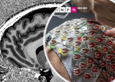 Epi_Control – EEG & MRI 7T Study